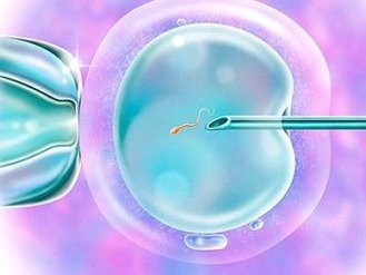 哈萨克斯坦试管婴儿技术领先医院排名，哪家医院做试管婴儿更佳？