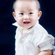 试管婴儿移植后脸发黄怎么回事？