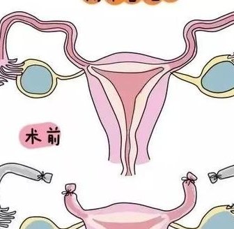 做试管的基础条件是什么？武汉做试管婴儿条件是什么？